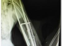 Radiografía de este Buitre leonado operado en el seno del proyecto “Banco criogénico en rapaces”